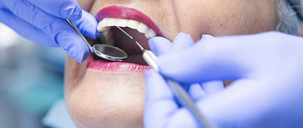 Best Chipped Tooth Repair Near Me  in Vandenberg Af, CA